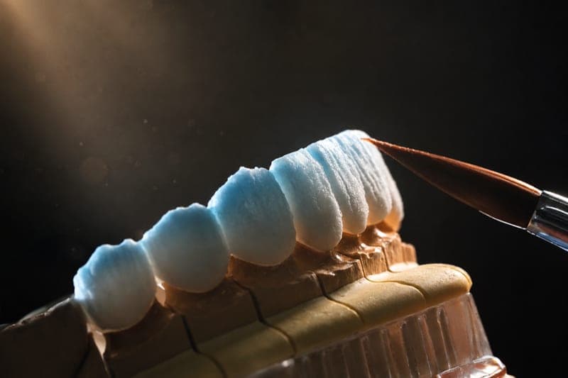 Porcelain fused zirconia — brush applying stain to an anterior bridge