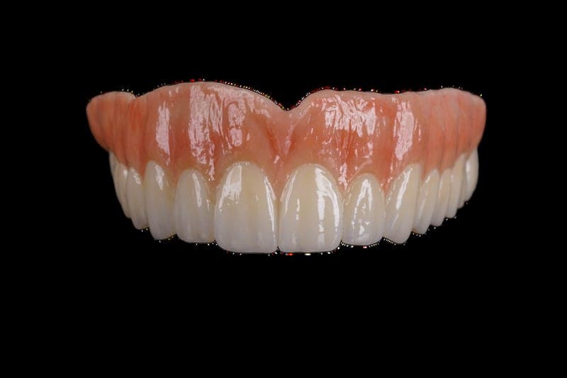 Zirconia overlay removable with a printed base