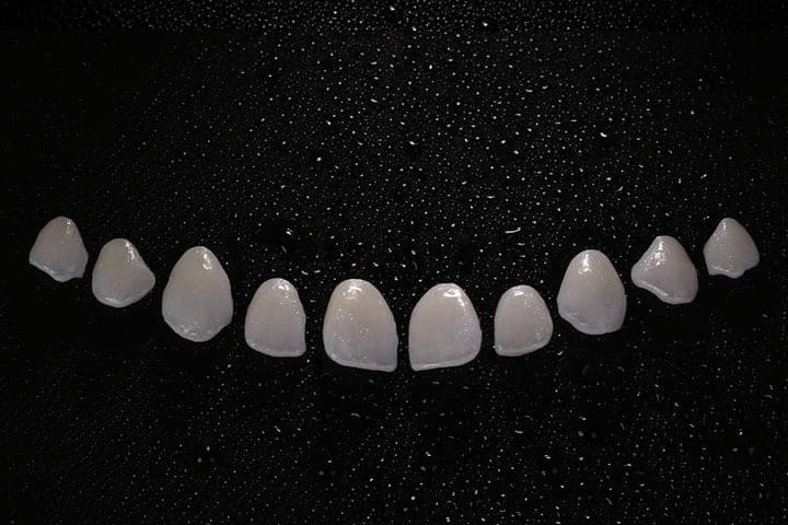 Zirconia veneers displayed outside the model on a dark surface